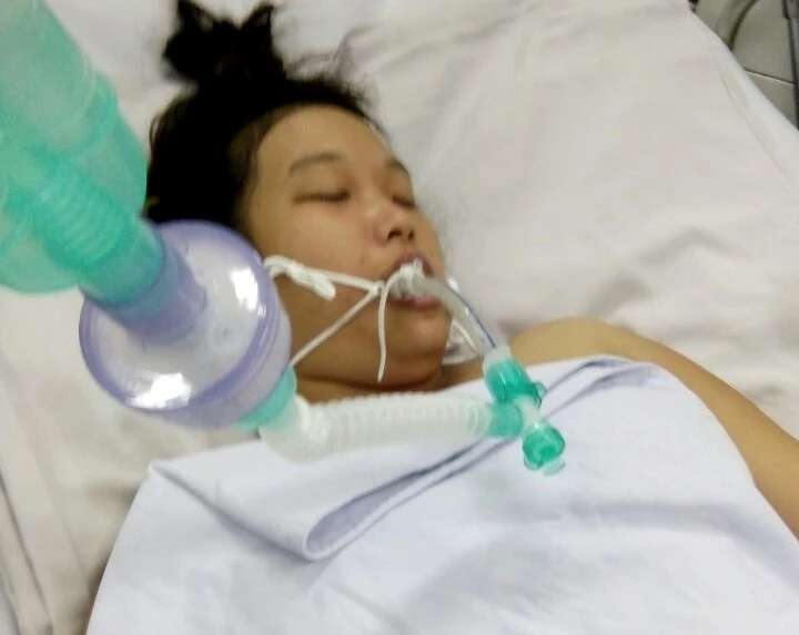 Giúp Nhi điều trị bệnh lao màng não